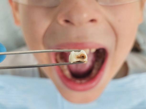 Best After-Hours Dental Trauma Care in Yaeyville, NC